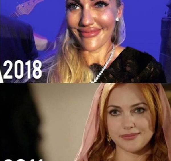 عکس های ییلدیز قبل از عمل