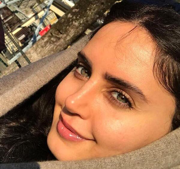 عکس قبل از عمل بینی الناز شاکردوست