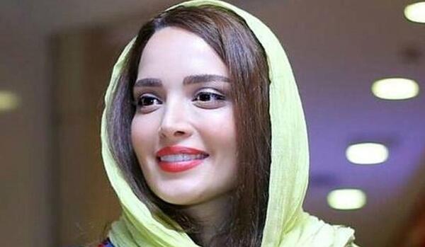 عکس بهنوش طباطبایی قبل عمل