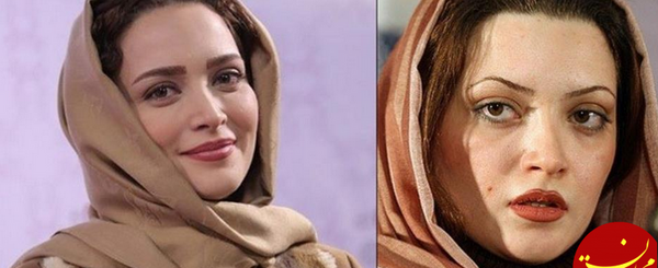عکس بهنوش طباطبایی قبل عمل