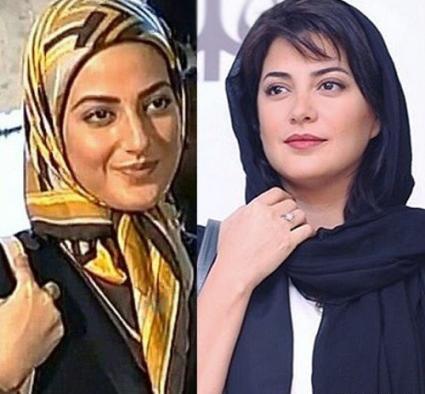 عکس بهنوش طباطبایی بعد از عمل بینی