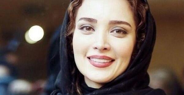 عکس بهنوش طباطبایی بعد از عمل بینی