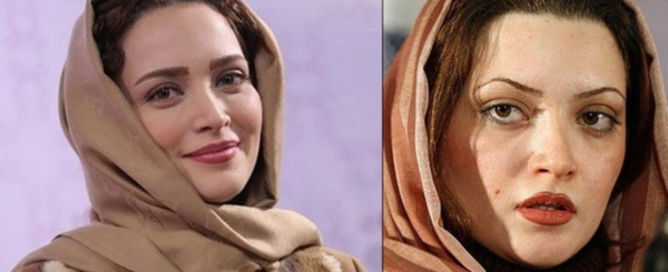 عکس بهنوش طباطبایی بعد از عمل بینی