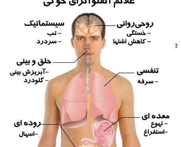 عکس از ویروس آنفولانزای خوکی