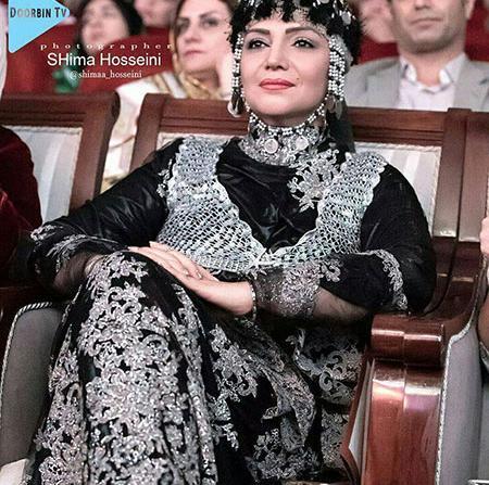 عکس های الهام پاوه نژاد قبل از عمل بینی