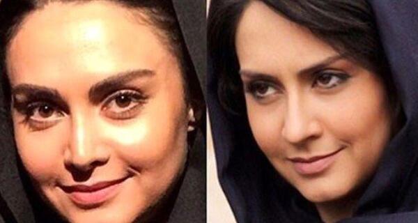 عکس های الهام پاوه نژاد قبل از عمل بینی