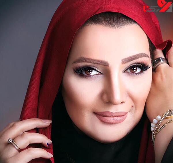 عکس های الهام پاوه نژاد قبل از عمل بینی
