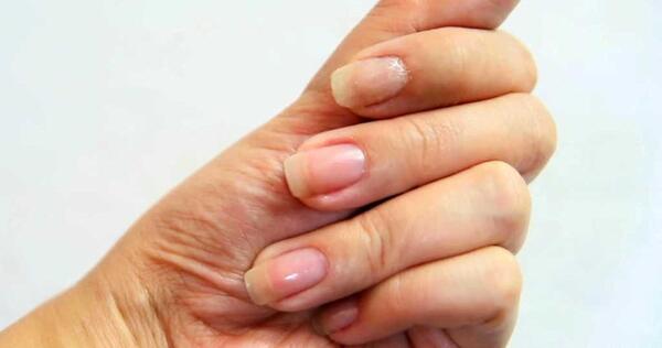 عکس ناخن شکسته دست