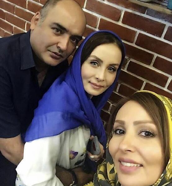 عکس پرستو صالحی قبل از عمل زیبایی