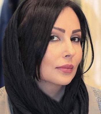 عکس پرستو صالحی قبل از عمل زیبایی
