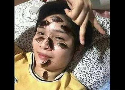 عکس سوسک روی صورت