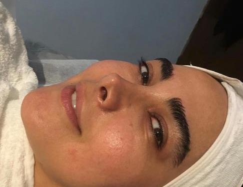 عکس آنا نعمتی قبل از عمل