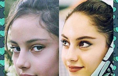 عکس نوزادی ترلان پروانه