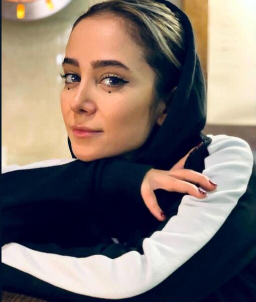 عکس الناز حبیبی قبل عمل بینی