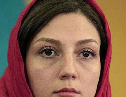 عکس لاغری حدیث میرامینی