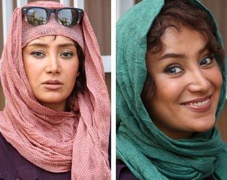 عکس بهاره افشاری قبل از عمل بینی