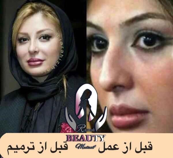 عکس نیوشا ضیغمی و الناز شاکردوست
