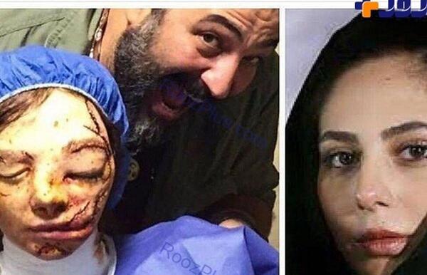 عکس وحشتناک صورت