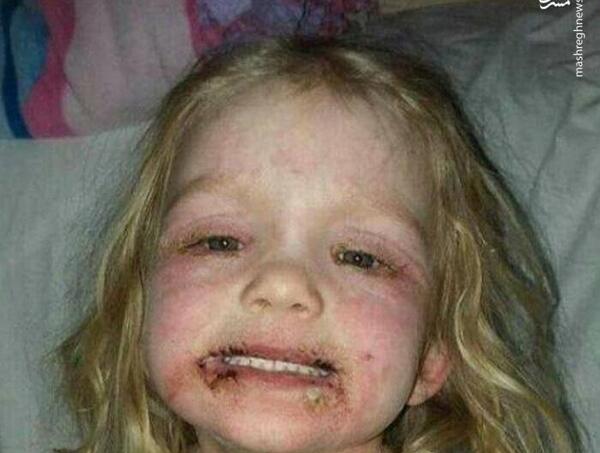 عکس وحشتناک صورت