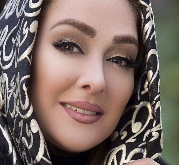 عکس الهام حمیدی بعد از عمل