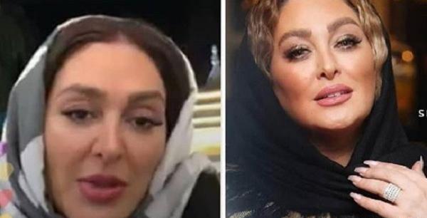 عکس الهام حمیدی بعد از عمل