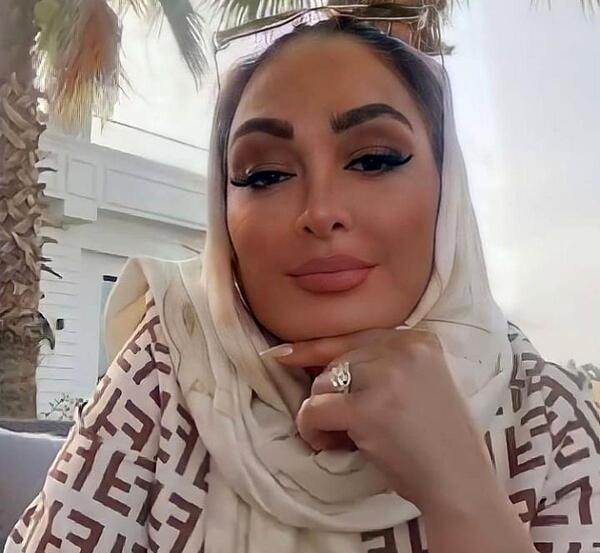 عکس الهام حمیدی بعد از عمل