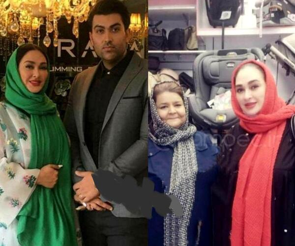 عکس الهام حمیدی بعد از عمل