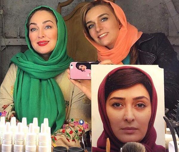 عکس الهام حمیدی بعد از عمل