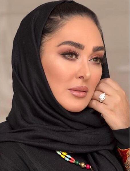 عکس الهام حمیدی بعد از عمل