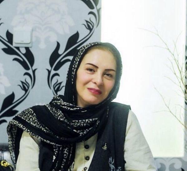 عکس افسانه بایگان قبل از عمل بینی