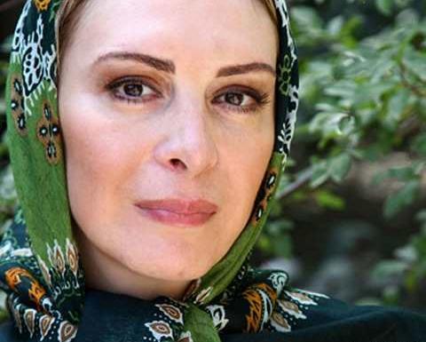 عکس افسانه بایگان قبل از عمل بینی