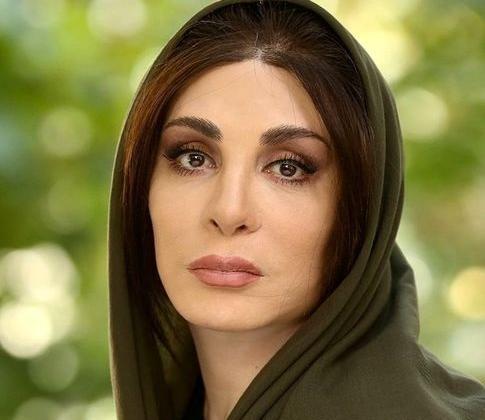 عکس افسانه بایگان قبل از عمل بینی