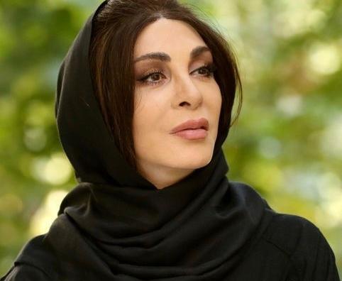 عکس افسانه بایگان قبل از عمل بینی