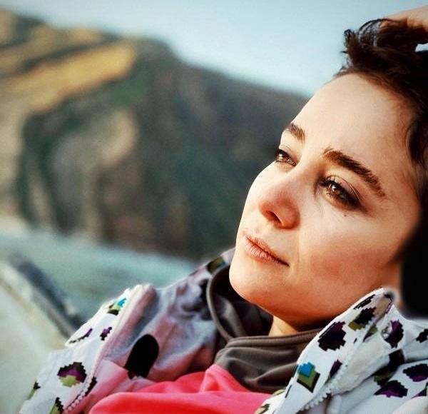 عکس الناز حبیبی قبل عمل