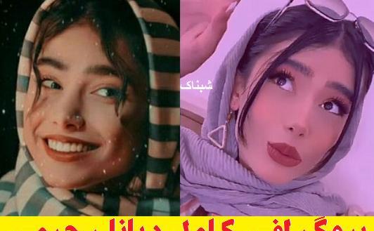 عکس قبل عمل دیانا رحیمی