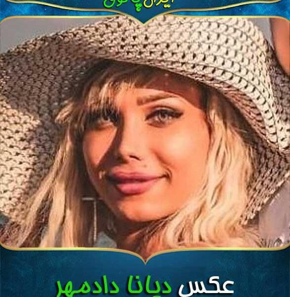 عکس قبل عمل دیانا رحیمی