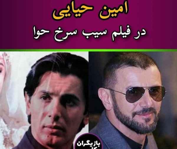 عکس امین حیایی قبل از عمل بینی
