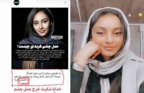 عکس چشم ترلان پروانه