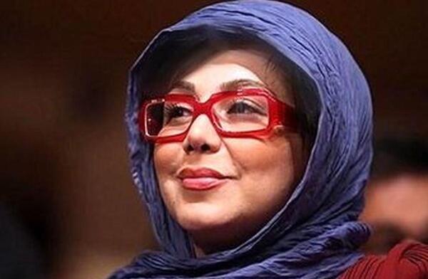 عکس بهنوش بختیاری قبل از عمل بینی
