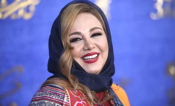 عکس بهنوش بختیاری قبل از عمل بینی