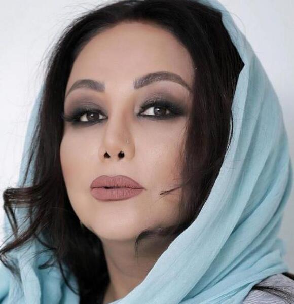 عکس بهنوش بختیاری قبل از عمل بینی