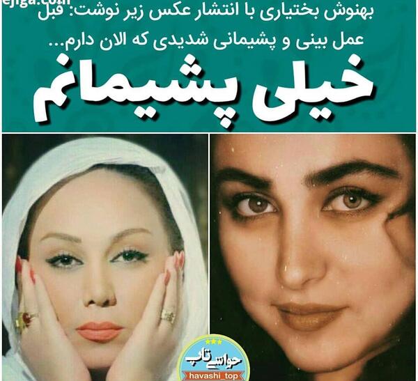 عکس بهنوش بختیاری قبل از عمل بینی