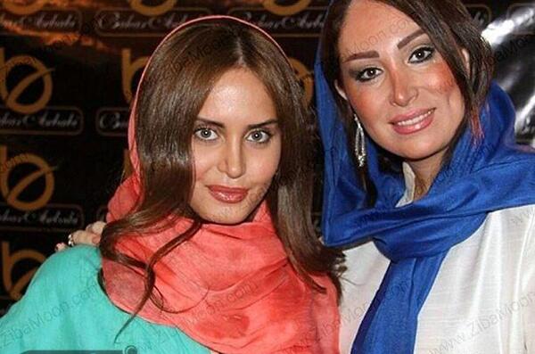 عکس الناز شاکردوست قبل و بعد از عمل بینی