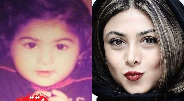 عکس آزاده صمدی قبل از عمل