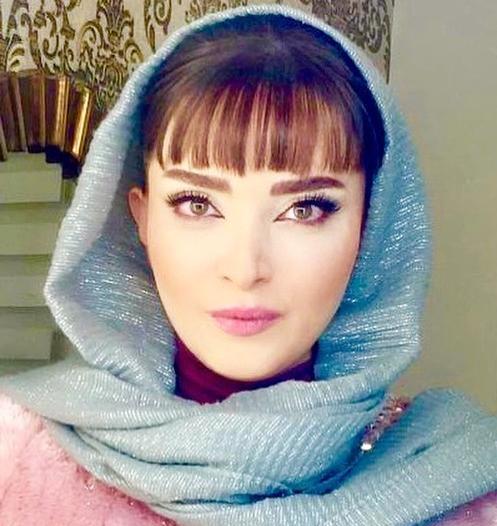 عکس بهنوش طباطبایی قبل و بعد عمل چشم