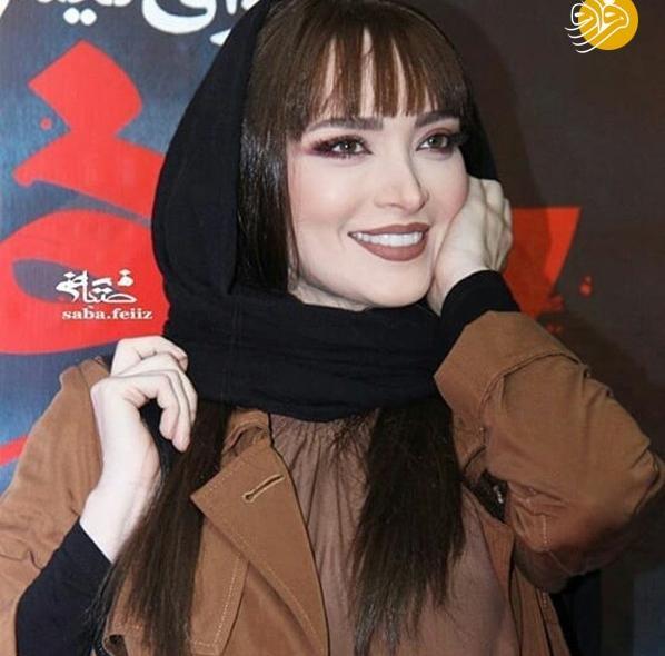 عکس بهنوش طباطبایی قبل و بعد عمل چشم