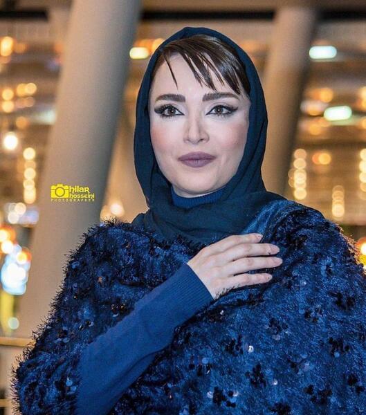 عکس بهنوش طباطبایی قبل و بعد عمل چشم