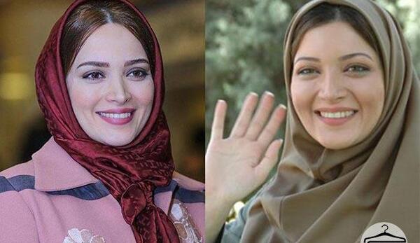 عکس بهنوش طباطبایی قبل و بعد عمل چشم