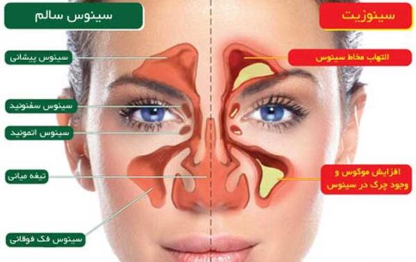 عکس داخل بینی کودک