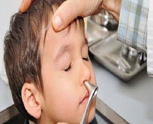 عکس داخل بینی کودک